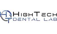 High Tech Dental Lab