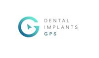 Dental Implants GPS